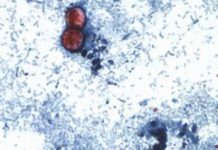 Funcionarios estadounidenses vinculan el brote de ciclospora que afecta a la lechuga iceberg con otros 3 estados.